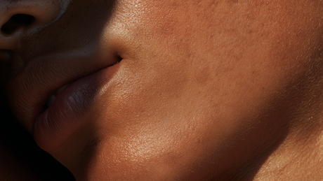 Diferença entre pele seca e pele desidratada