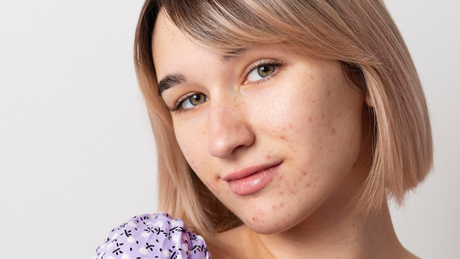 Como evitar manchas no rosto