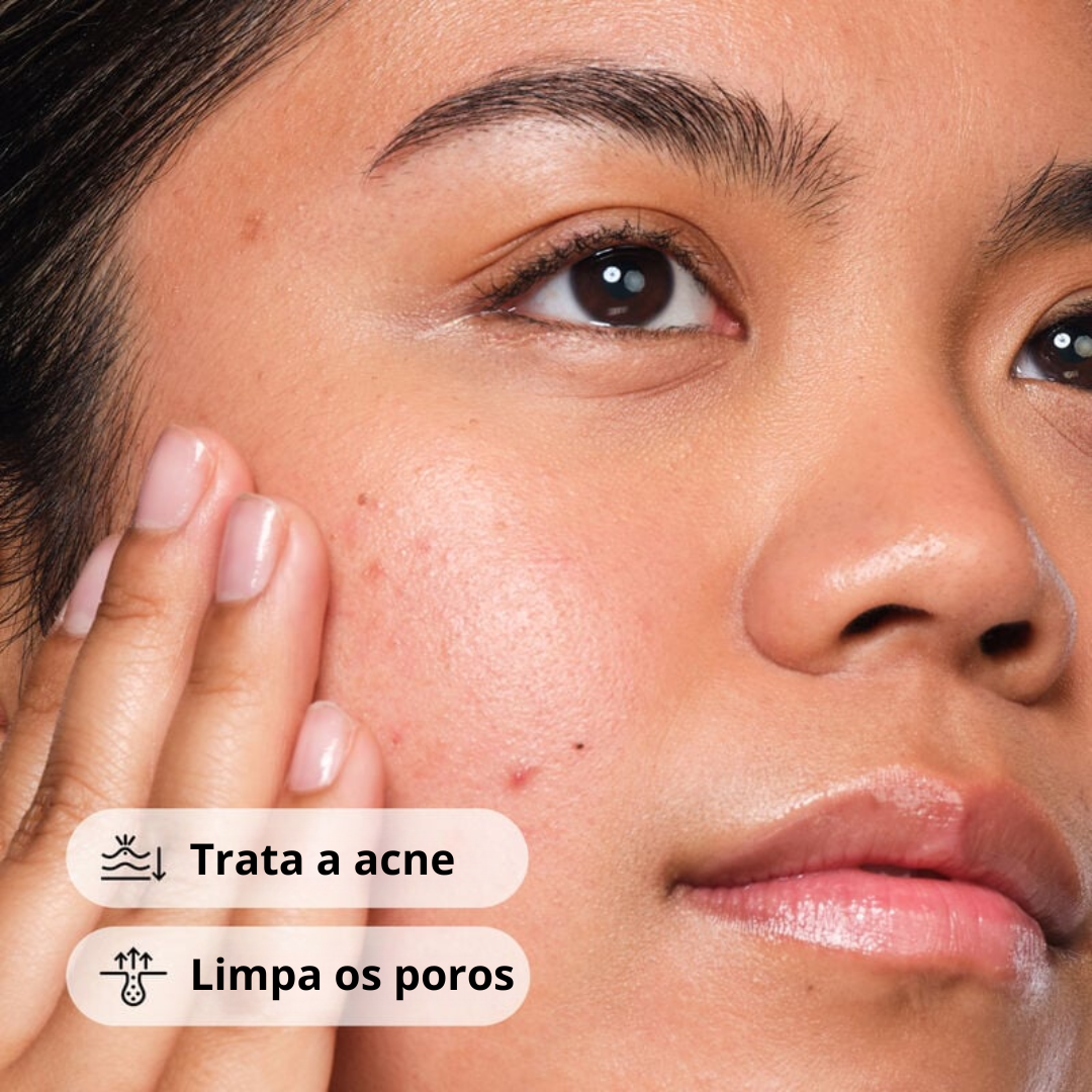 The Ordinary Salicylic Acid 2% Sérum Antiacne