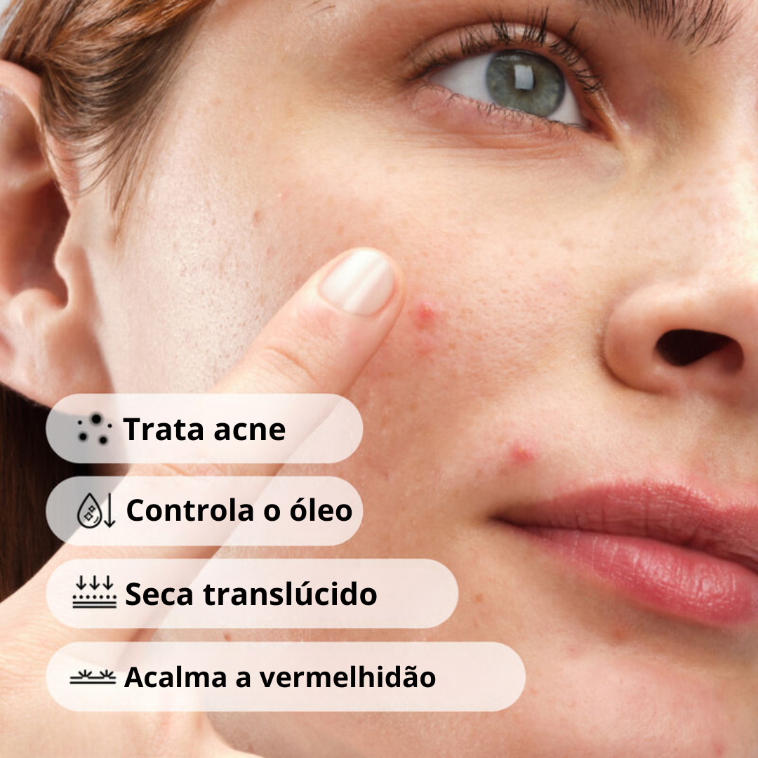 The Ordinary Sulfur 10% Concentrado com Enxofre