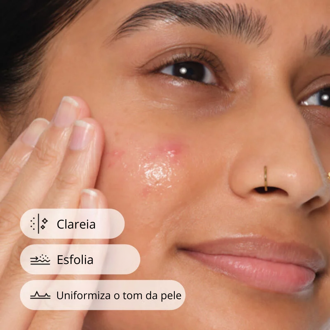 The Ordinary Salicylic Acid 2% Tratamento para Espinhas