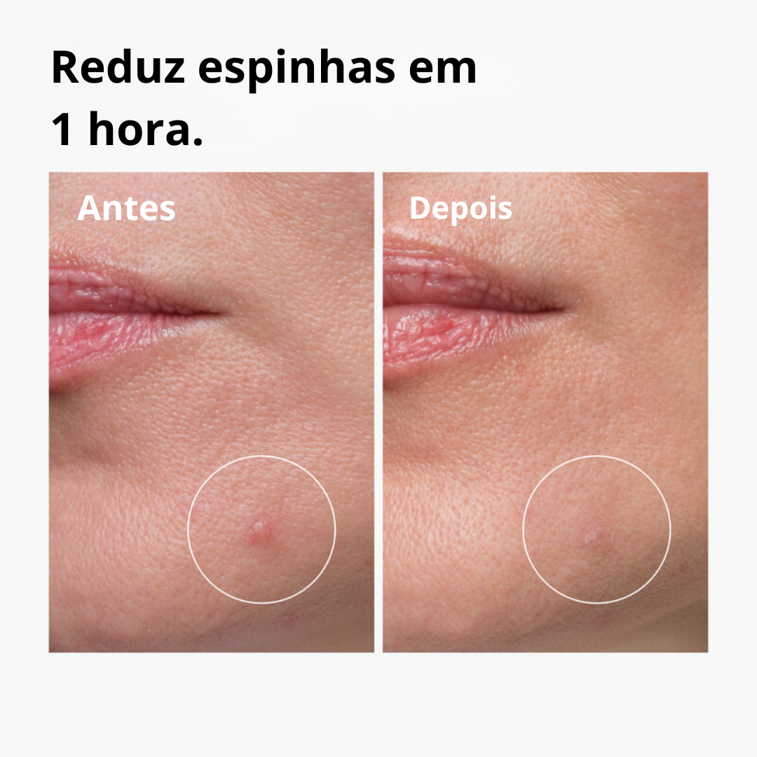 The Ordinary Sulfur 10% Concentrado com Enxofre