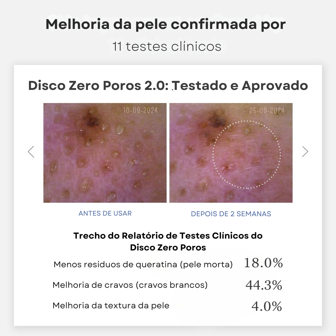 Cuidados com poros dilatados com Medicube