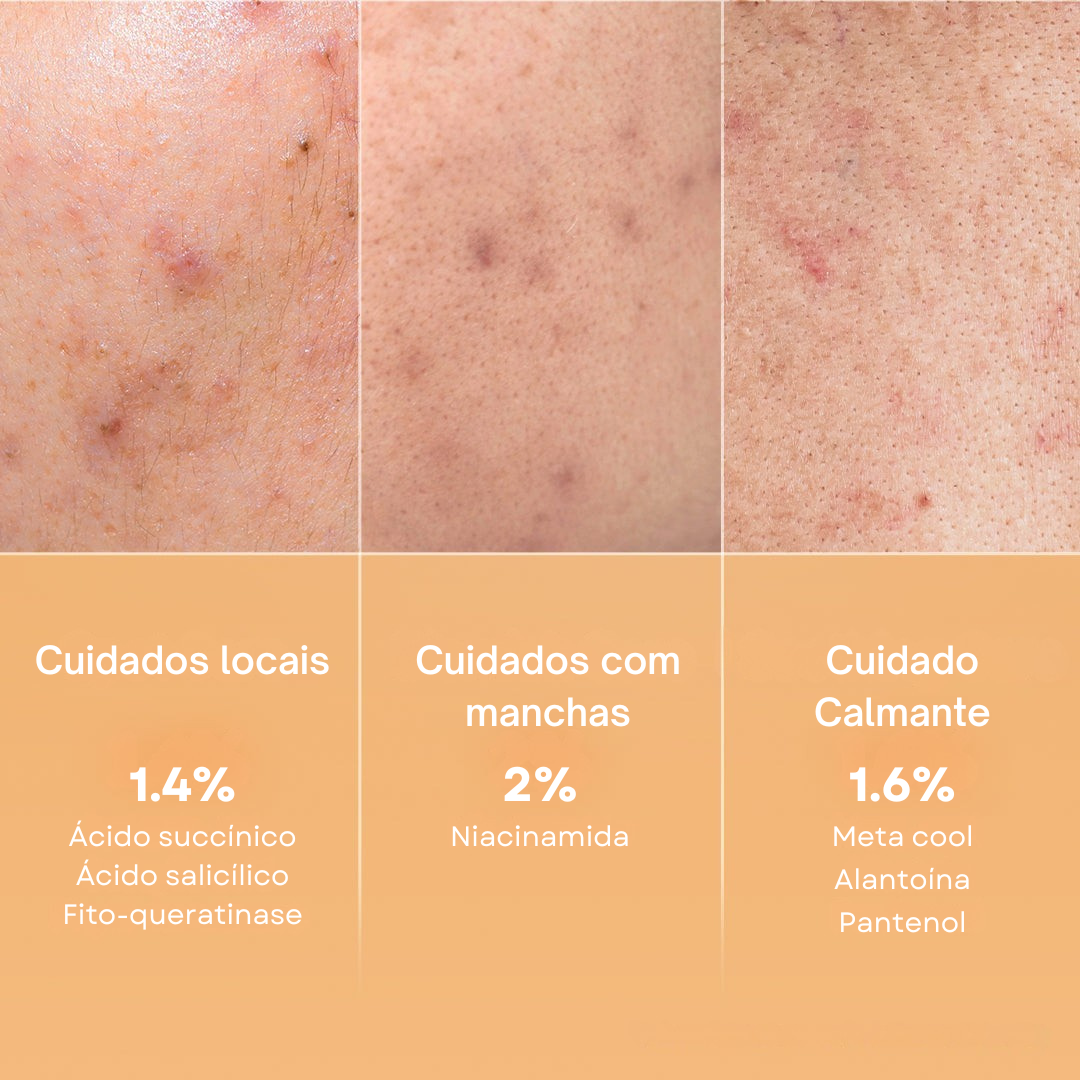 Redução de marcas e oleosidade com pads