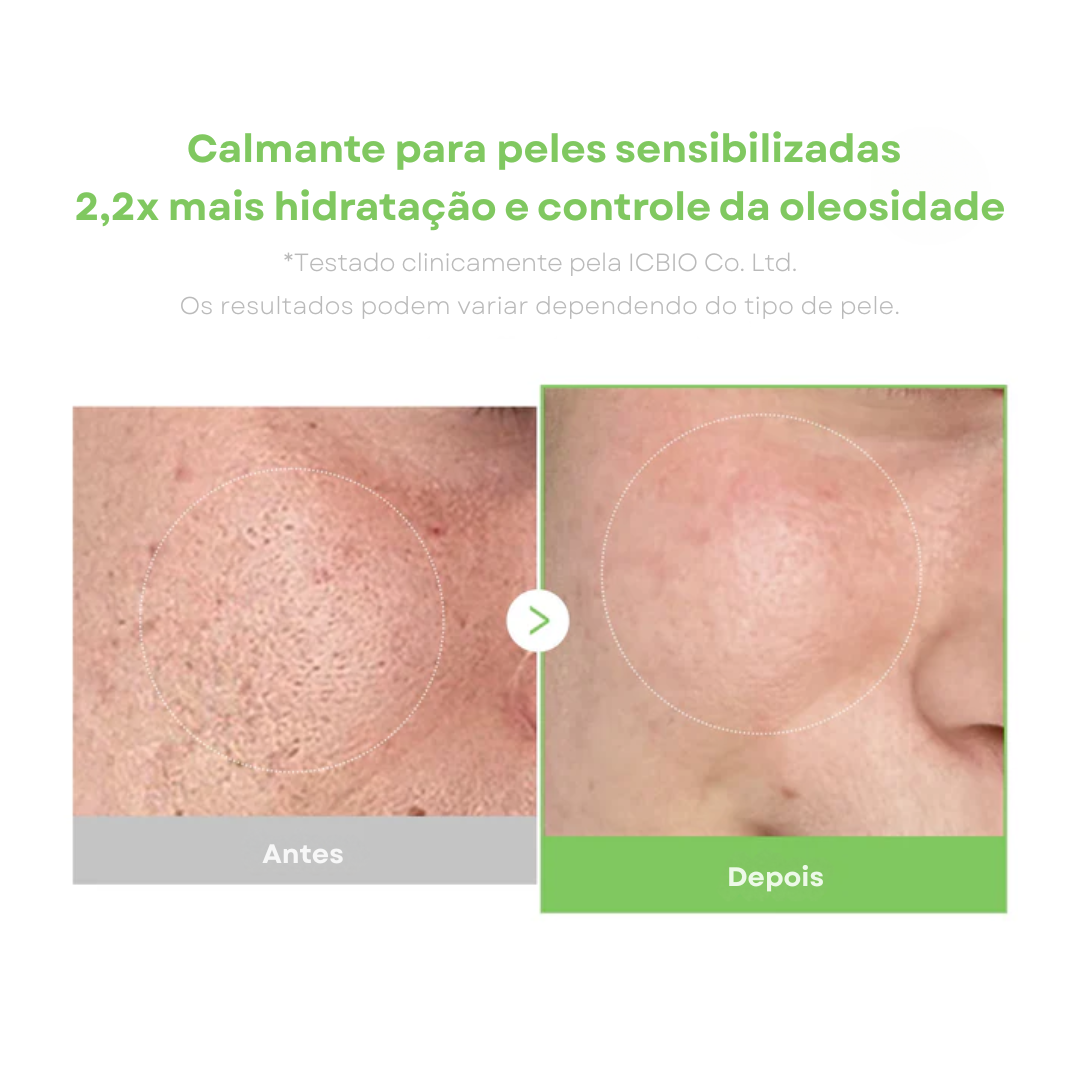 Creme para vermelhidão e oleosidade