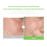 Creme para vermelhidão e oleosidade
